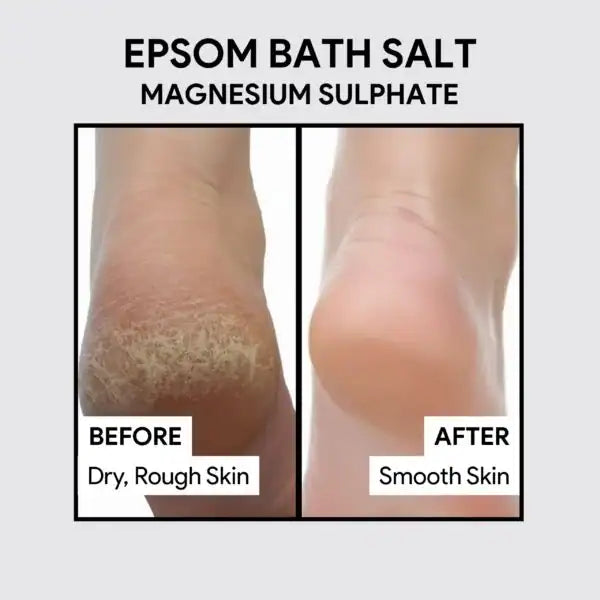 Epsom Salt (Magnesium Sulphate) USP Grade